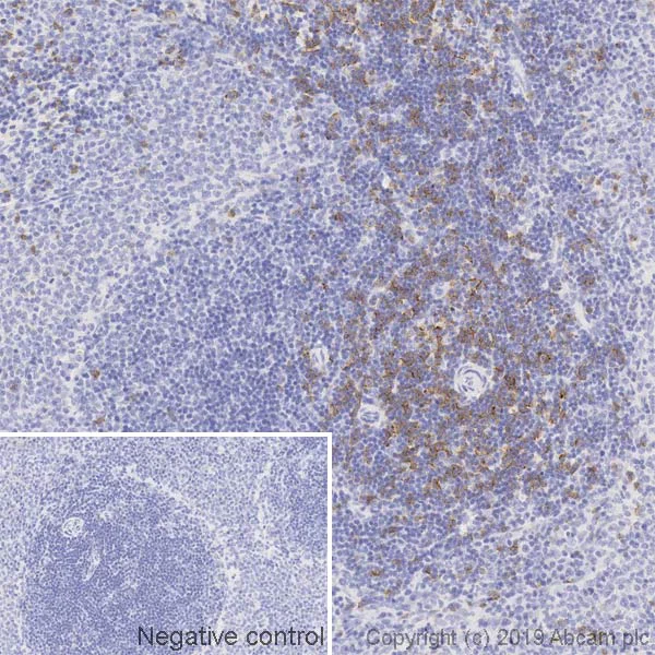 Anti-CD8 alpha antibody [OX-8] (ab33786) | Abcam