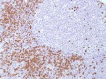 Immunohistochemistry (Formalin/PFA-fixed paraffin-embedded sections) - CD8 alpha Antibody Panel (EP1150Y, SP16, SP239, CAL66, CAL67) (AB252196)