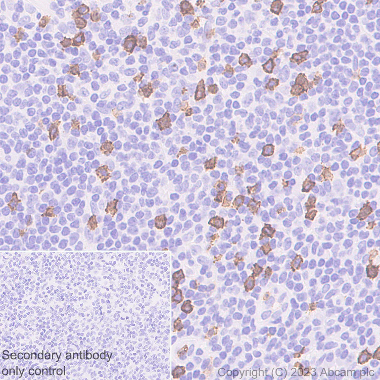 Immunohistochemistry (Formalin/PFA-fixed paraffin-embedded sections) - Anti-CD8 alpha antibody [RM1129] - BSA and Azide free (AB316779)