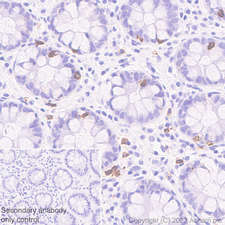 Immunohistochemistry (Formalin/PFA-fixed paraffin-embedded sections) - Anti-CD8 alpha antibody [RM1129] - BSA and Azide free (AB316779)