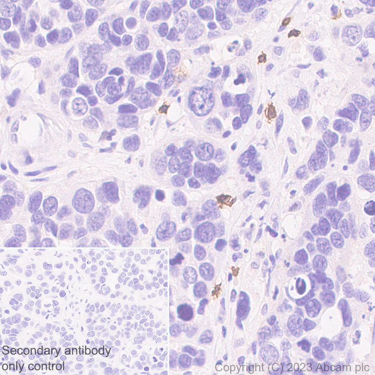 Immunohistochemistry (Formalin/PFA-fixed paraffin-embedded sections) - Anti-CD8 alpha antibody [RM1129] - BSA and Azide free (AB316779)