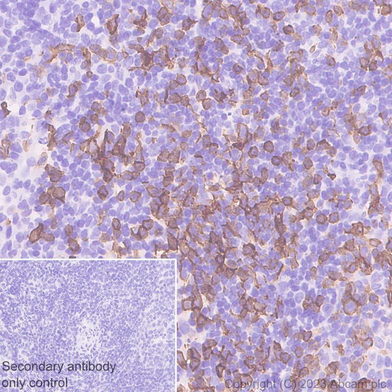 Immunohistochemistry (Formalin/PFA-fixed paraffin-embedded sections) - Anti-CD8 alpha antibody [RM1129] - BSA and Azide free (AB316779)