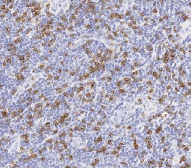 Immunohistochemistry (Formalin/PFA-fixed paraffin-embedded sections) - Anti-CD8 alpha antibody [SP16] (AB101500)