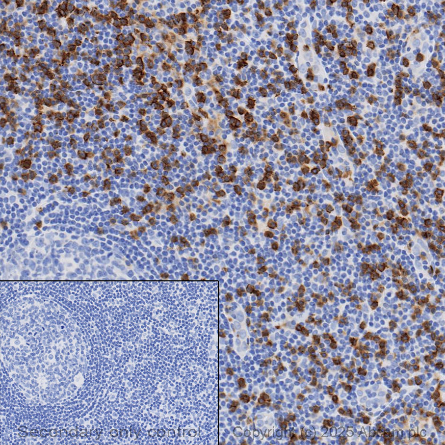 Immunohistochemistry (Formalin/PFA-fixed paraffin-embedded sections) - Anti-CD8 alpha antibody [SP16] (AB101500)