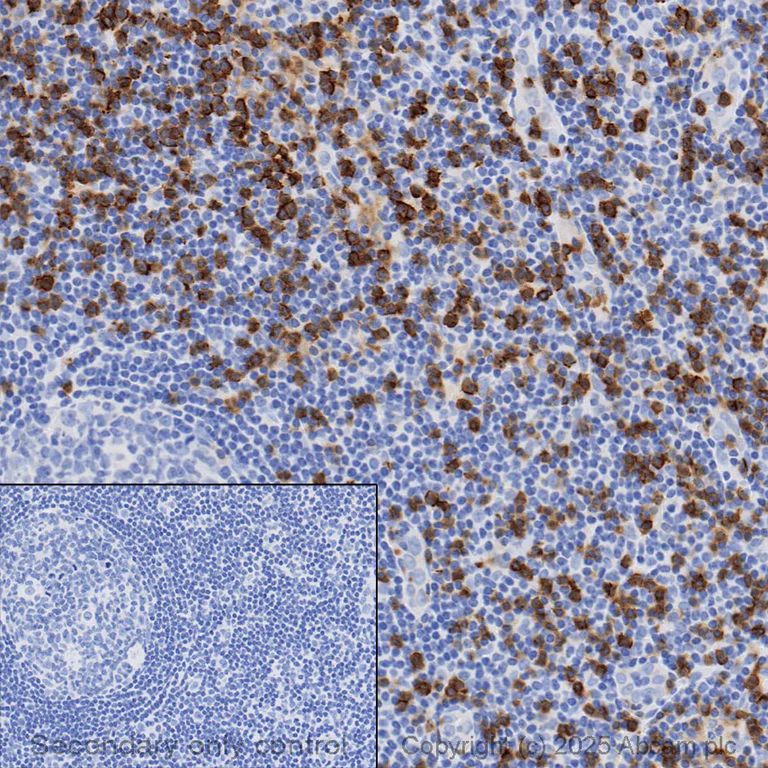 Immunohistochemistry (Formalin/PFA-fixed paraffin-embedded sections) - Anti-CD8 alpha antibody [SP16] - BSA and Azide free (AB307844)
