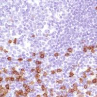 Immunohistochemistry (Formalin/PFA-fixed paraffin-embedded sections) - Anti-CD8 alpha antibody [SP239] (AB178089)