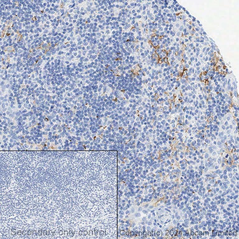 Immunohistochemistry (Formalin/PFA-fixed paraffin-embedded sections) - Anti-CD8 alpha antibody [SP239] (AB178089)