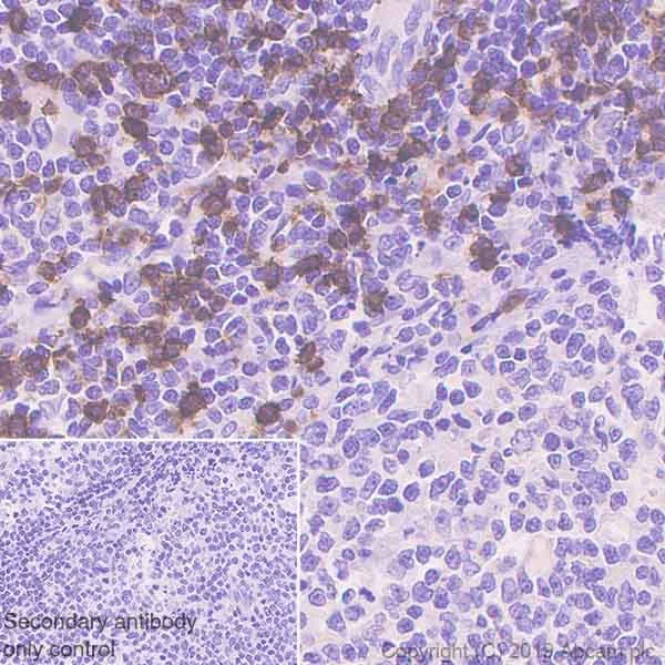Anti-CD8 alpha antibody [SP239] (ab178089) | Abcam