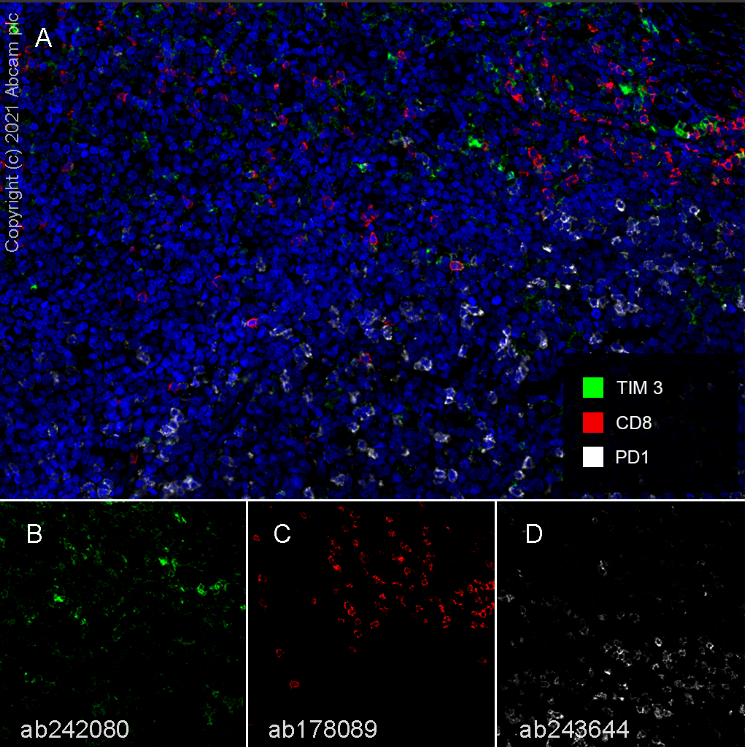 Multiplex immunohistochemistry - Anti-CD8 alpha antibody [SP239] - BSA and Azide free (AB236230)