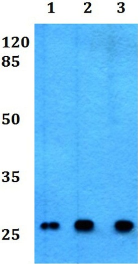 Western blot - Anti-CD8 beta antibody (AB191905)