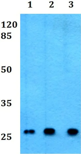 Western blot - Anti-CD8 beta antibody (AB191905)