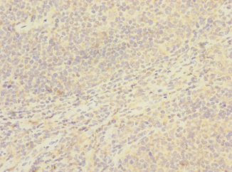 Immunohistochemistry (Formalin/PFA-fixed paraffin-embedded sections) - Anti-CD8 beta antibody (AB238549), expandable thumbnail