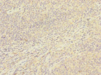 Immunohistochemistry (Formalin/PFA-fixed paraffin-embedded sections) - Anti-CD8 beta antibody (AB238549)