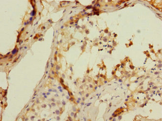 Immunohistochemistry (Formalin/PFA-fixed paraffin-embedded sections) - Anti-CD8 beta antibody (AB238549), expandable thumbnail