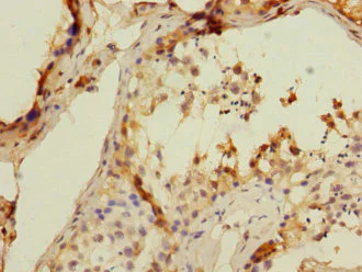Immunohistochemistry (Formalin/PFA-fixed paraffin-embedded sections) - Anti-CD8 beta antibody (AB238549)