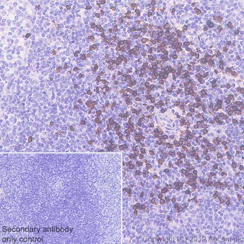 Immunohistochemistry (Formalin/PFA-fixed paraffin-embedded sections) - Anti-CD8 beta antibody [EPR22331-54] (AB228965)