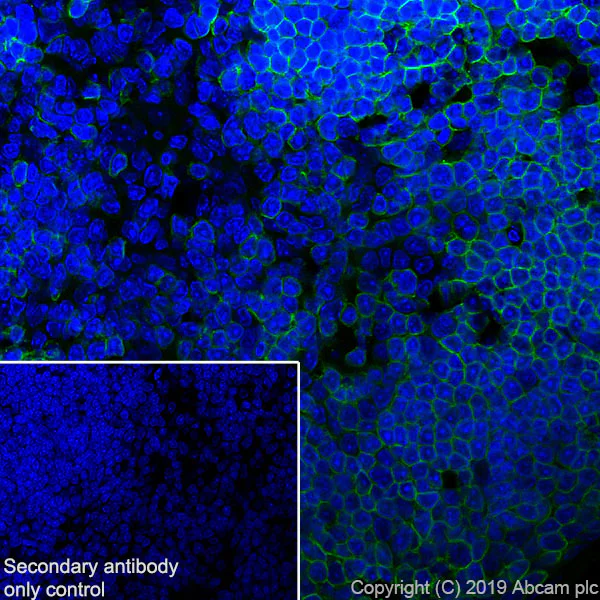 Immunohistochemistry (Frozen sections) - Anti-CD8 beta antibody [EPR22331-54] (AB228965)
