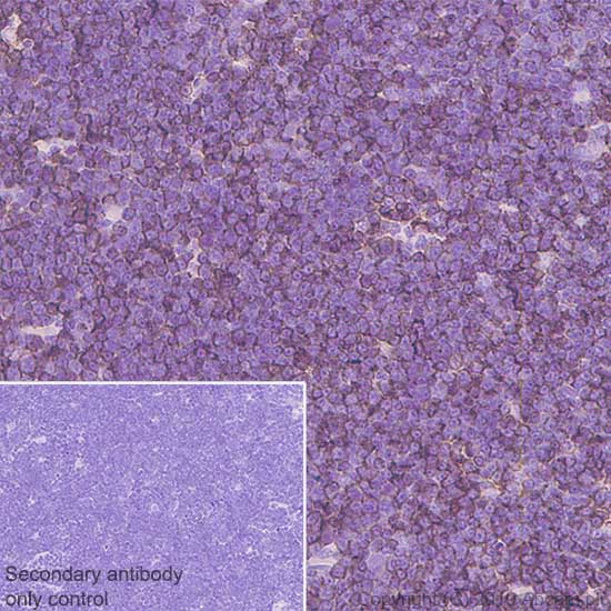 Immunohistochemistry (Formalin/PFA-fixed paraffin-embedded sections) - Anti-CD8 beta antibody [EPR22331-54] - BSA and Azide free (AB254197)