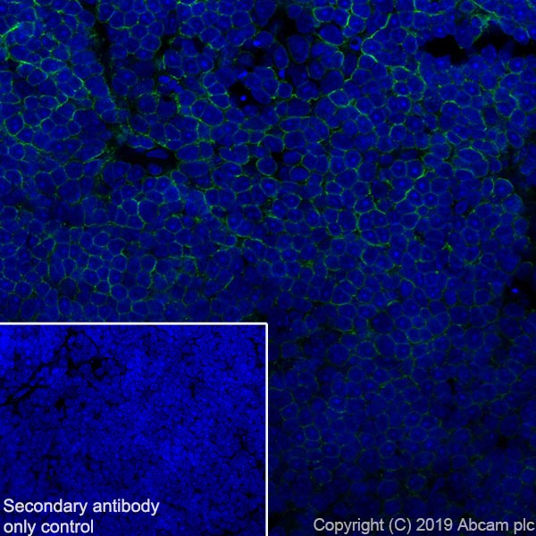 Immunohistochemistry (Frozen sections) - Anti-CD8 beta antibody [EPR22331-81] (AB263946), expandable thumbnail