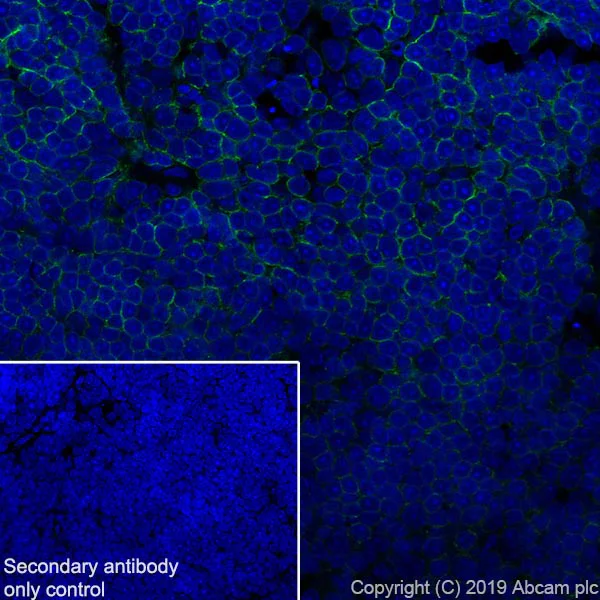 Immunohistochemistry (Frozen sections) - Anti-CD8 beta antibody [EPR22331-81] (AB263946)
