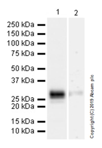 Western blot - Anti-CD8 beta antibody [EPR22331-81] (AB263946), expandable thumbnail