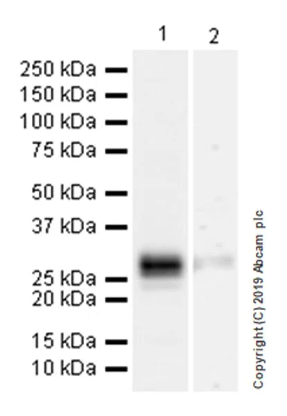 Western blot - Anti-CD8 beta antibody [EPR22331-81] (AB263946)