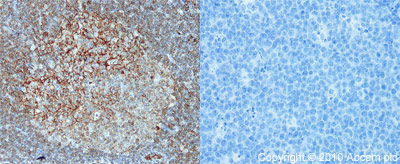 Immunohistochemistry (Formalin/PFA-fixed paraffin-embedded sections) - Anti-CD80 antibody (AB64116)