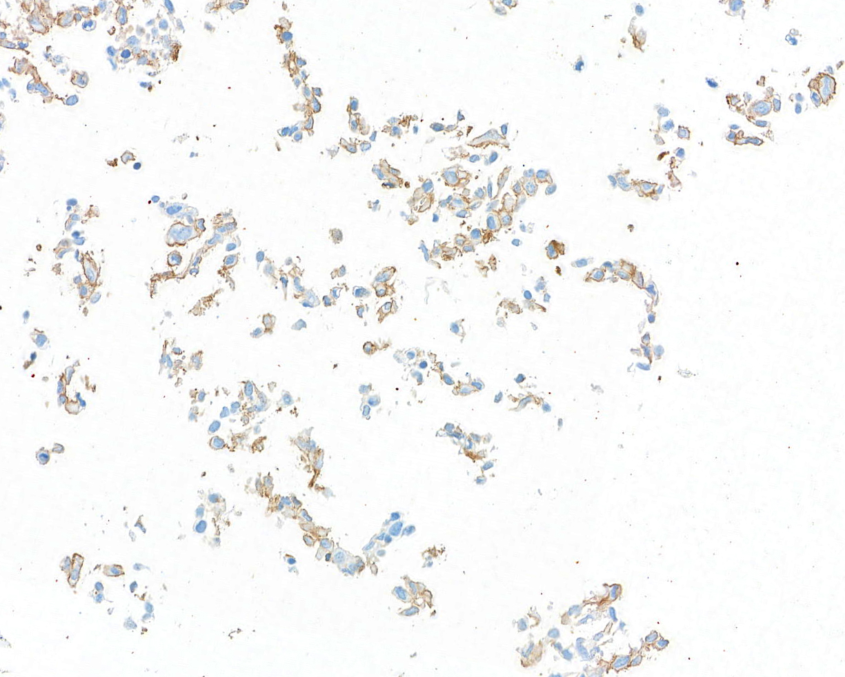 Immunocytochemistry - Anti-CD80 antibody [BLR237K] - BSA free (AB314098), expandable thumbnail