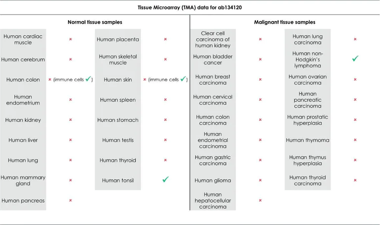 Immunohistochemistry (Formalin/PFA-fixed paraffin-embedded sections) - Anti-CD80 antibody [EPR1157(2)] (AB134120)