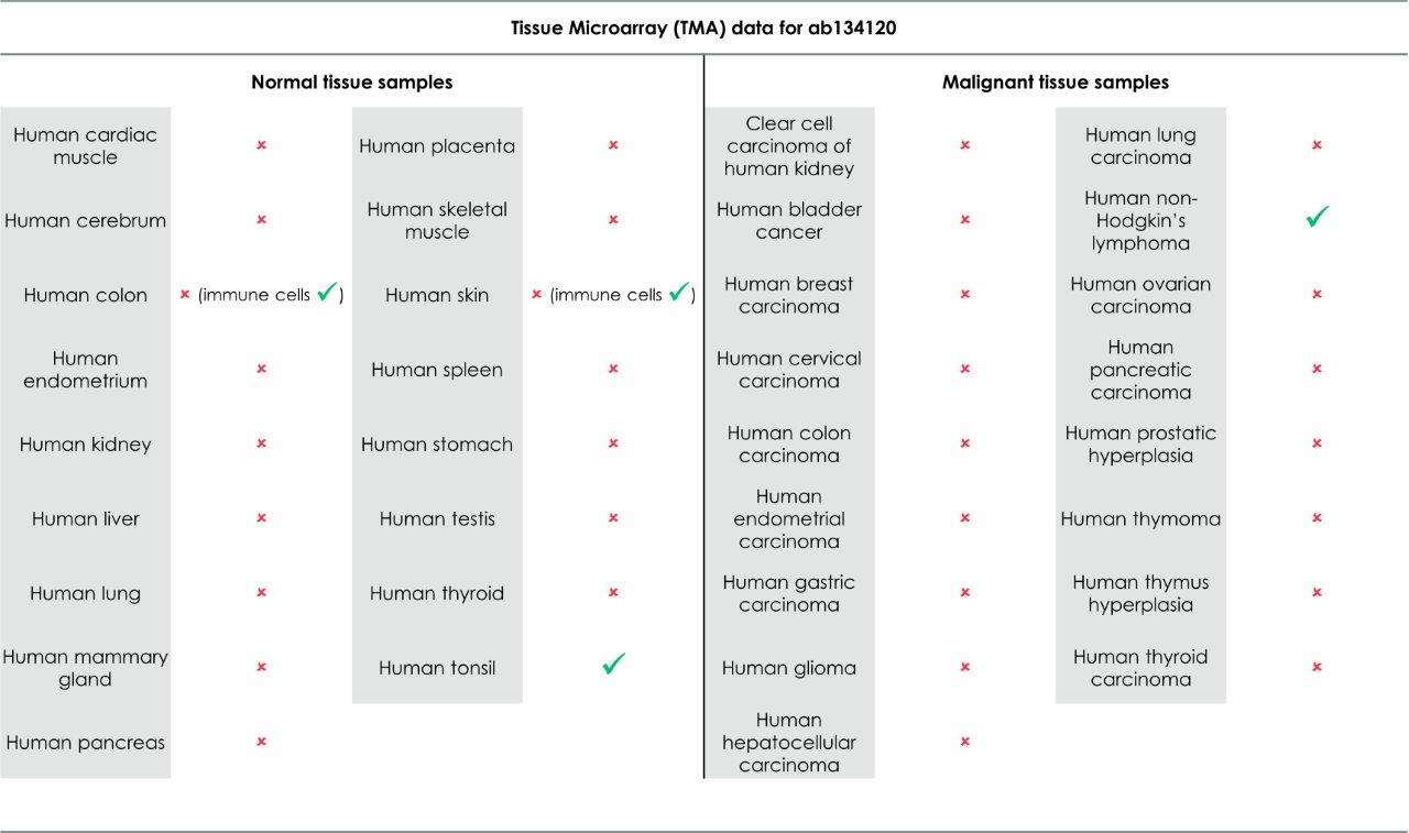 Immunohistochemistry (Formalin/PFA-fixed paraffin-embedded sections) - Anti-CD80 antibody [EPR1157(2)] - Low endotoxin, Azide free (AB224797)