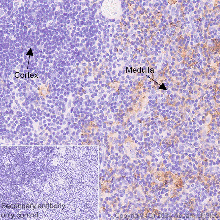 Immunohistochemistry (Formalin/PFA-fixed paraffin-embedded sections) - Anti-CD80 antibody [EPR28978-182] (AB322922)
