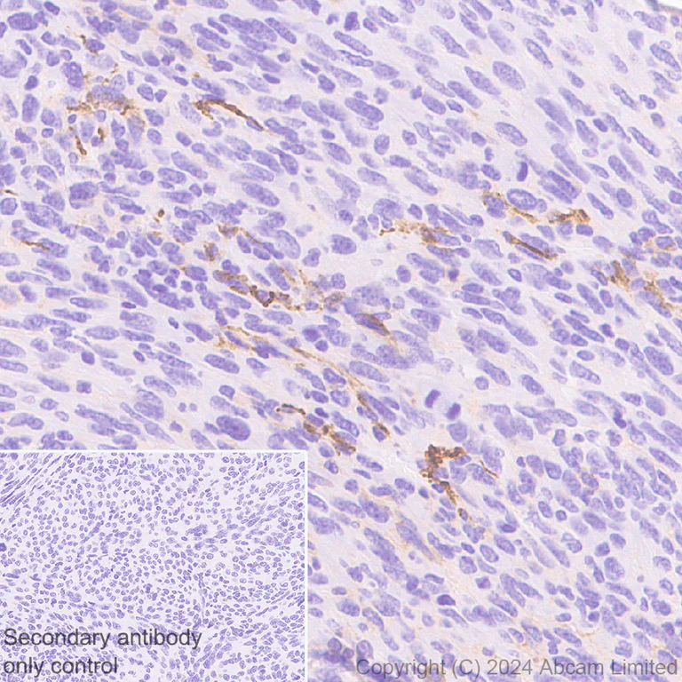 Immunohistochemistry (Formalin/PFA-fixed paraffin-embedded sections) - Anti-CD80 antibody [EPR28978-182] (AB322922)