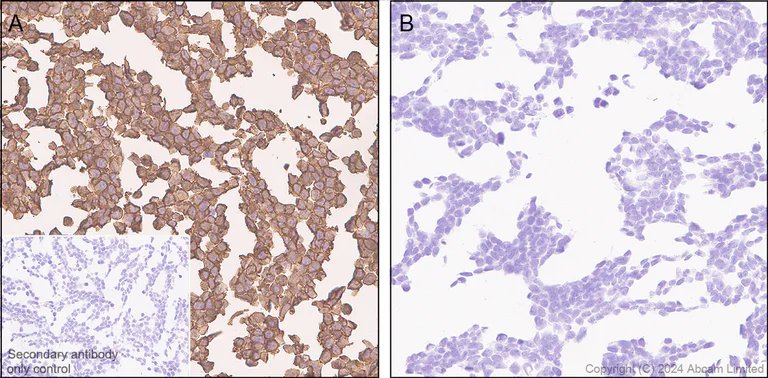 Immunohistochemistry (Formalin/PFA-fixed paraffin-embedded sections) - Anti-CD80 antibody [EPR28978-182] (AB322922)