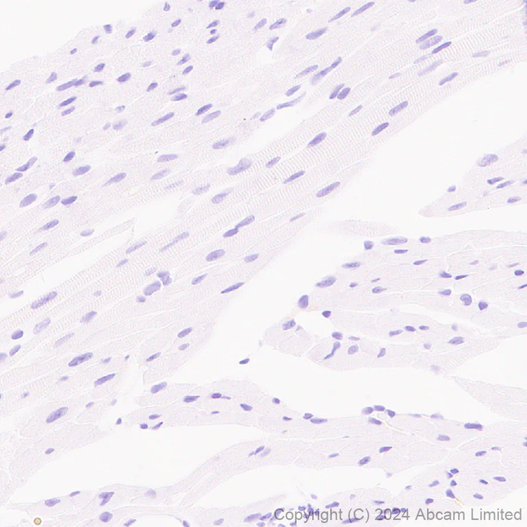 Immunohistochemistry (Formalin/PFA-fixed paraffin-embedded sections) - Anti-CD80 antibody [EPR28978-182] (AB322922)