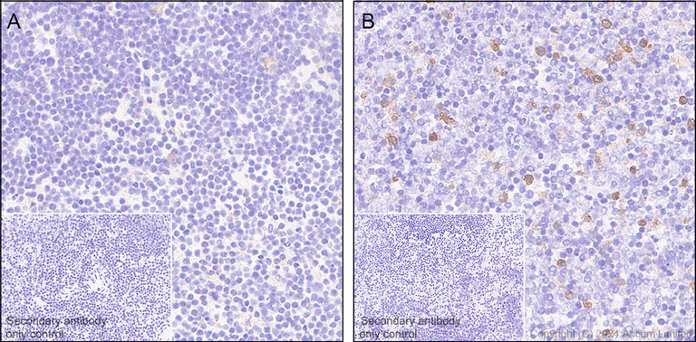Immunohistochemistry (Formalin/PFA-fixed paraffin-embedded sections) - Anti-CD80 antibody [EPR28978-182] - BSA and Azide free (AB325966)