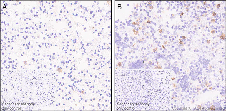 Immunohistochemistry (Formalin/PFA-fixed paraffin-embedded sections) - Anti-CD80 antibody [EPR28978-182] - BSA and Azide free (AB325966)