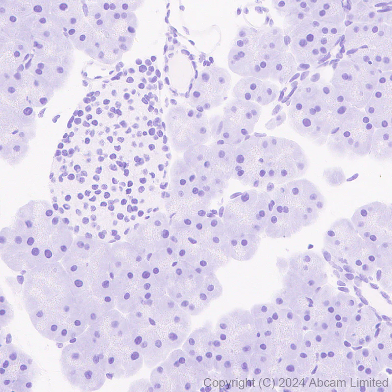 Immunohistochemistry (Formalin/PFA-fixed paraffin-embedded sections) - Anti-CD80 antibody [EPR28978-182] - BSA and Azide free (AB325966)