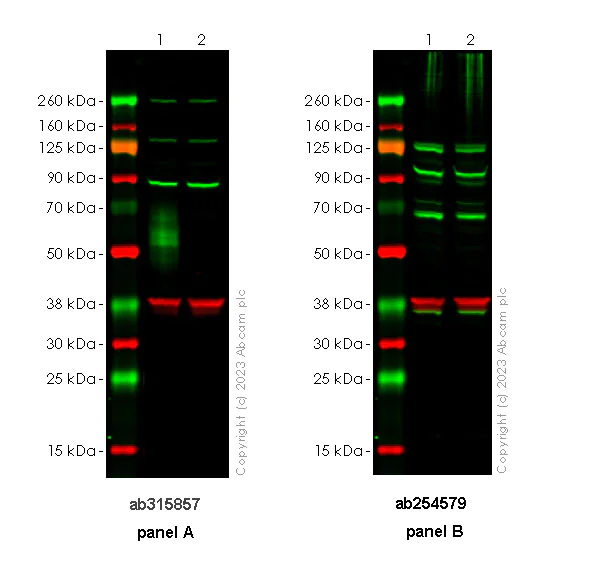 Western blot - Anti-CD80 antibody [RM1104] (AB315857)