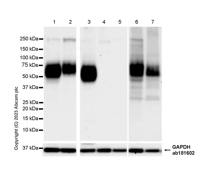 Western blot - Anti-CD80 antibody [RM1104] - BSA and Azide free (AB315858)