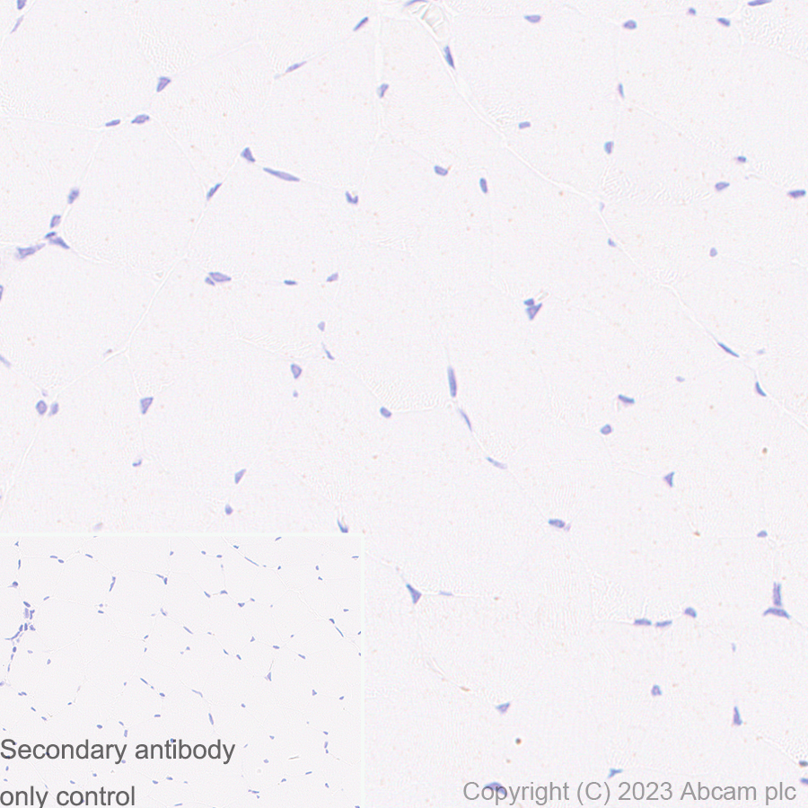 Immunohistochemistry (Formalin/PFA-fixed paraffin-embedded sections) - Anti-CD80 antibody [RM1133] (AB315832)