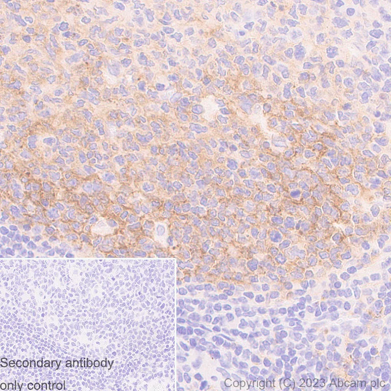 Immunohistochemistry (Formalin/PFA-fixed paraffin-embedded sections) - Anti-CD80 antibody [RM1133] - BSA and Azide free (AB315833)
