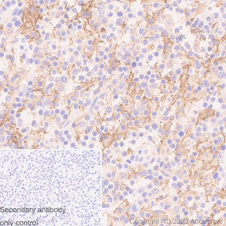 Immunohistochemistry (Formalin/PFA-fixed paraffin-embedded sections) - Anti-CD80 antibody [RM1133] - BSA and Azide free (AB315833)
