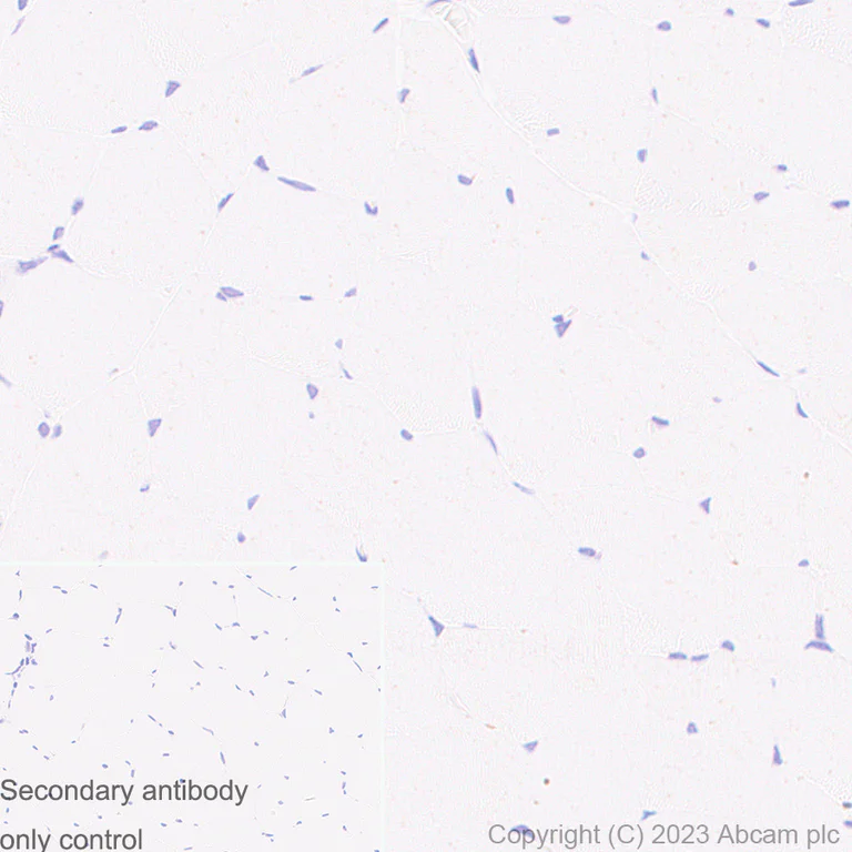 Immunohistochemistry (Formalin/PFA-fixed paraffin-embedded sections) - Anti-CD80 antibody [RM1133] - BSA and Azide free (AB315833)