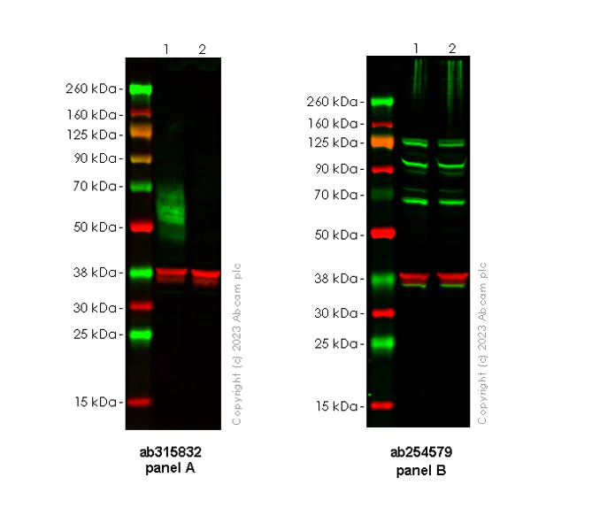 Western blot - Anti-CD80 antibody [RM1133] - BSA and Azide free (AB315833)