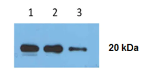 Western blot - Anti-CD81 antibody [A1504] (AB286173)