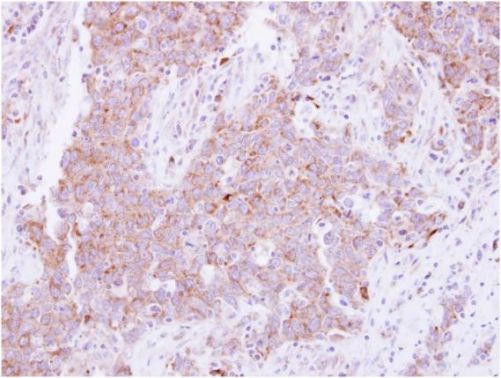 Immunohistochemistry (Formalin/PFA-fixed paraffin-embedded sections) - Anti-CD81 antibody (AB155760)