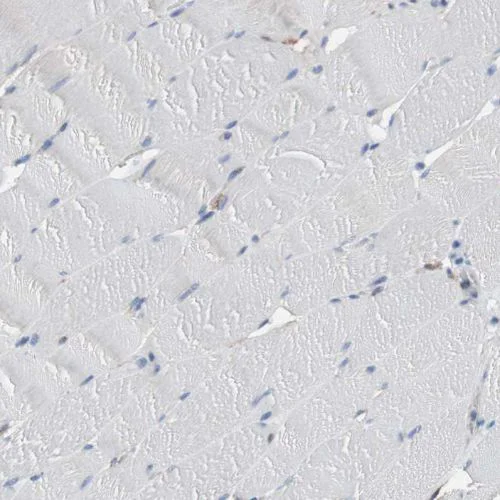 Immunohistochemistry (Formalin/PFA-fixed paraffin-embedded sections) - Anti-CD81 antibody (AB244297)