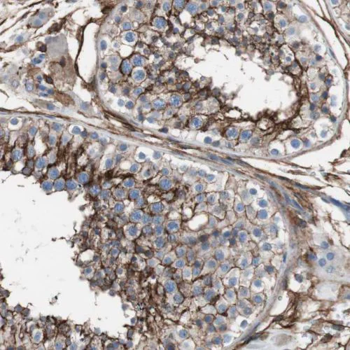 Immunohistochemistry (Formalin/PFA-fixed paraffin-embedded sections) - Anti-CD81 antibody (AB244297)