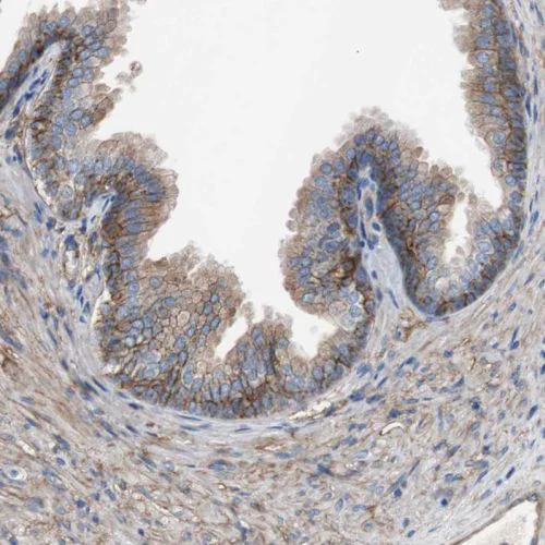 Immunohistochemistry (Formalin/PFA-fixed paraffin-embedded sections) - Anti-CD81 antibody (AB244297)