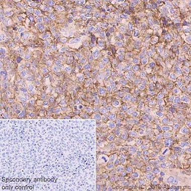 Immunohistochemistry (Formalin/PFA-fixed paraffin-embedded sections) - Anti-CD81 antibody [EPR21916] - BSA and Azide free (AB233692), expandable thumbnail